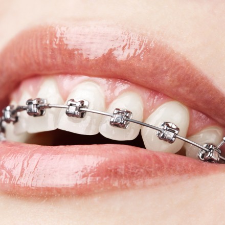 Orthodontics