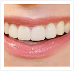 Cosmetic Dentistry Singapore Cosmetic Dentistry Singapore