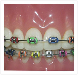 Orthodontics Singapore Orthodontics Singapore