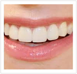Cosmetic Dentistry Singapore