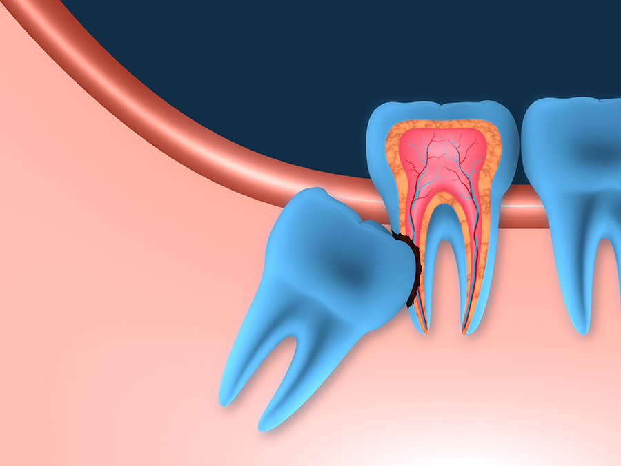 Cosmetic Dentistry Specialising In Dental Implants Orthodontics Root Canal Treatment